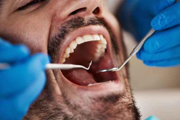 Best Emergency Gum Pain Relief  in Bridgeport, OH